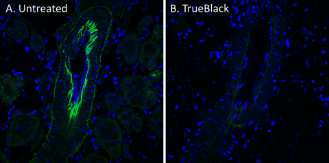 TrueBlack-rat-kidney