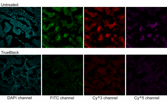 Trueblack autofluorescence