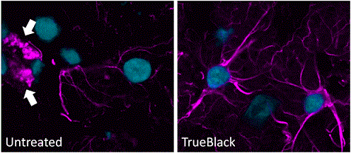 trueblack lipofuscin quenching