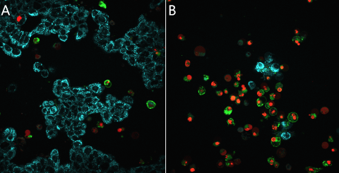 MitoView-Blue-NucView-530-CF488A-Annexin-MCF7-composite